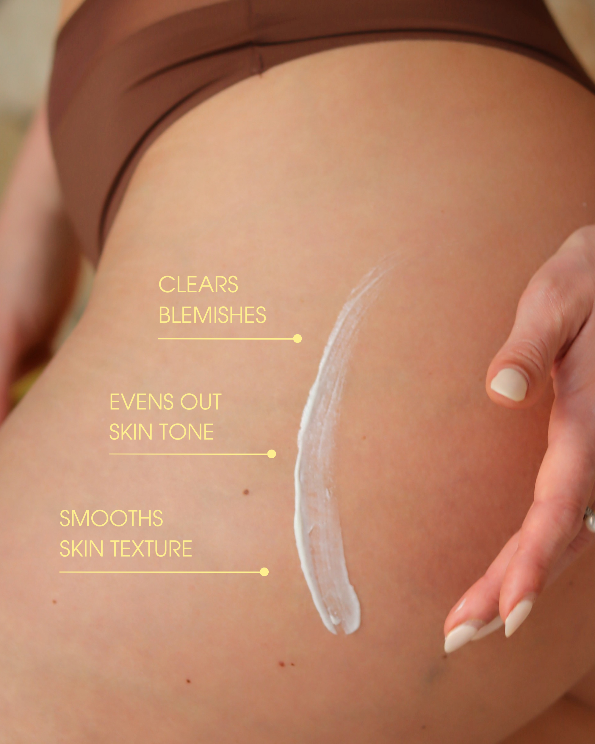 Butt Blemish Cream